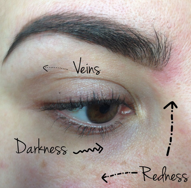 tired_eyes_1